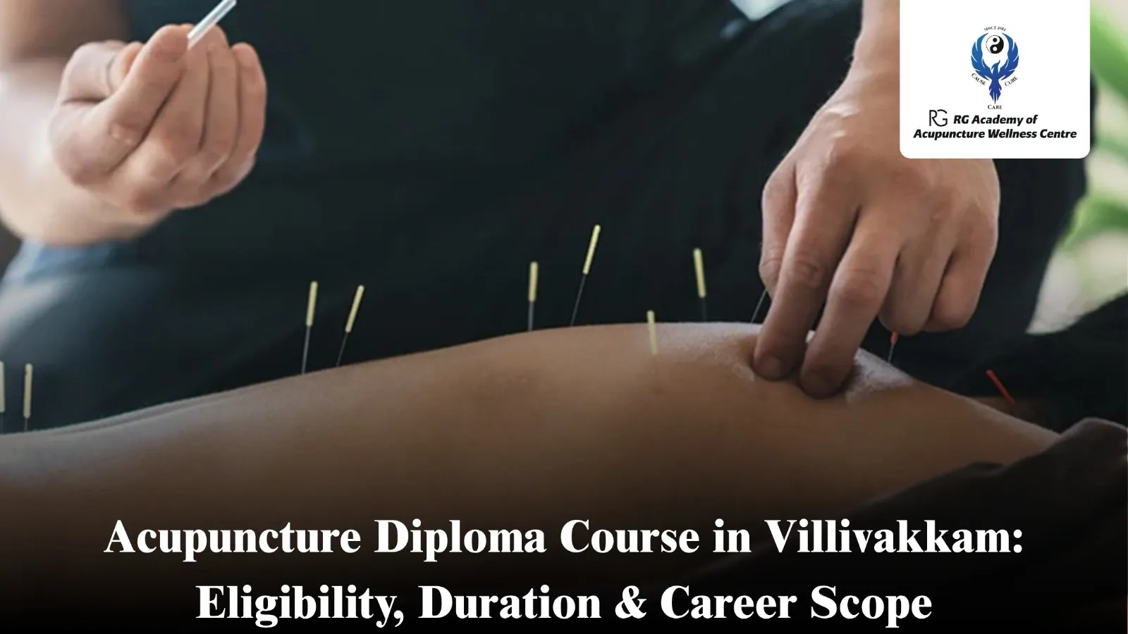Acupuncture Diploma Course in Villivakkam | RG Academy