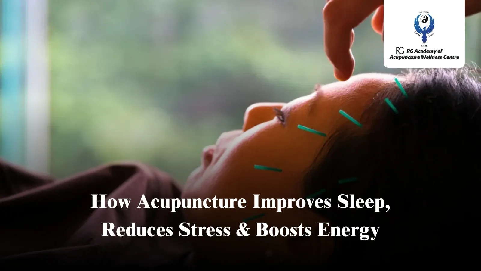 Acupuncture Treatment Chennai | Sleep, Stress & Energy